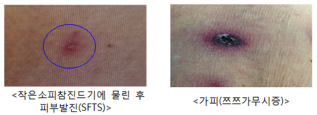 1fbe35db37bfd51209f78d8f8ee0c591_1741076564_0031.png